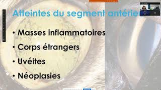 Webinaire FAS echographie en ophtalmologie pathologie [upl. by Adnolohs]