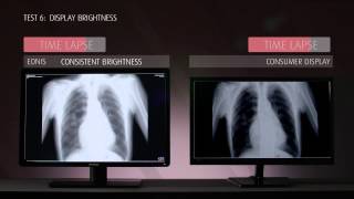 Just how precise are Barcos Eonis medical displays comparative testing [upl. by Audi]