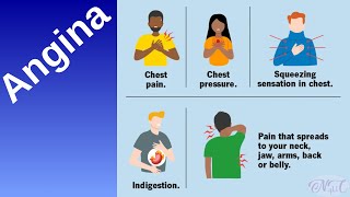 Angina  Angina Pectoris  Simple description of Angina pain Angina notes [upl. by Vanya]