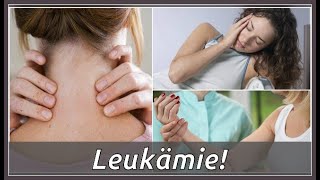 Das sind Symptome von Leukämie [upl. by Noman]