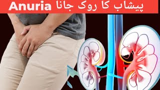 What is Anuria When Kidneys Stop Producing Urine Causes  Symptoms Investigations and Treatment [upl. by Asilav234]