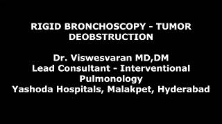 Rigid Bronchoscopic Tumor Debulking  Electrosurgical snaring  Cryoextraction [upl. by Hcirteid]