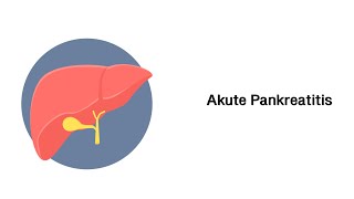 Akute Bauchspeicheldrüsenentzündung Akute Pankreatitis [upl. by Gerdeen]