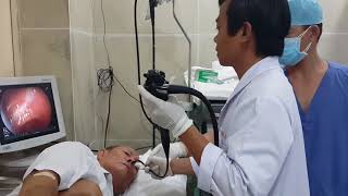 Transnasal Gastroscopy [upl. by Rebak]