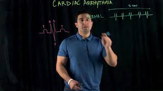 Cardiac Arrhythmia [upl. by Oelc]