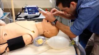 RSI part 3 Intubation [upl. by Leroy]