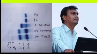 Hemoglobin electrophoresis procedure demonstration  Hemoglobin electrophoresis [upl. by Nonaihr]