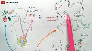 Angiostrongyliasis  Angiostrongylus cantonensis  Life cycle  Angiostrongylus costaricensis [upl. by Dhumma]