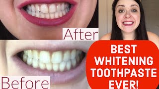 BEST WHITENING TOOTHPASTE EVER REVIEW Crest 3D White Brilliance [upl. by Jun863]