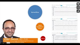 Ceribell EEG for Risk Stratification [upl. by Punak530]