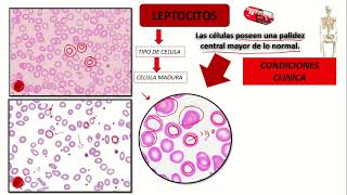 LEPTOCITOS Hematologia [upl. by Walcott]