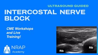 NRAP Academy Ultrasound Guided Intercostal Nerve Block for PostMastectomy Pain Syndrome￼￼ [upl. by Leshia482]