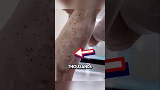 Extremely satisfying bug removal 😱 shorts oddlysatisfying [upl. by Finn485]