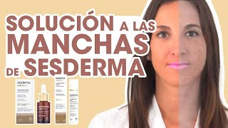 TRATAMIENTO ANTIMANCHAS Sesderma rostro libre de manchas solares I Al detalle [upl. by Aicemak]