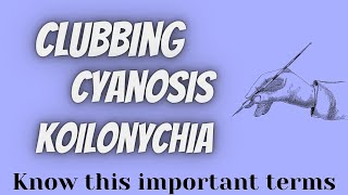 ClubbingCyanosisKoilonychia [upl. by Siberson305]