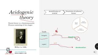 3Dental Caries Theories Of Etiology 1 [upl. by Lemaj612]