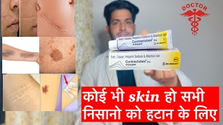 Contractubex gel  Contractubex review  Contractubex gel uses in hindi  contractubex gel uses [upl. by Femi]