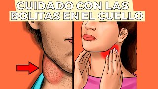 ¿Por qué tengo BOLITAS EN EL CUELLO cómo se trata y cuando ir al doctor [upl. by Chisholm]