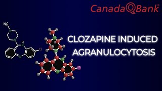 Clozapine induced Agranulocytosis [upl. by Puto]