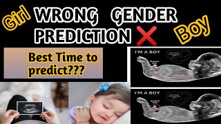 WRONG GENDER PREDICTION❌Baby BoyTurtle Sign🐢 [upl. by Clari281]