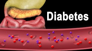 Diabetes Type 1 and Type 2 Animation [upl. by Assirialc]