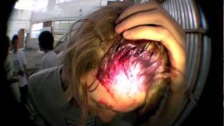 Skateboard to the face [upl. by Olatha]