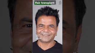 Rajpal Yadav hair bollywood actor love viralvideo daliy vlog SRK birthday Aishwarya Abhishek div [upl. by Sigmund]