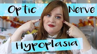 What is Optic Nerve Hypoplasia Why I’m Registered Blind  Fashioneyesta [upl. by Airam]