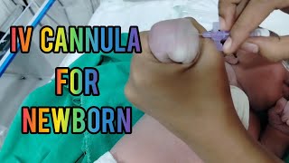 How To Insert Iv CanulaJelco  Iv Cannulation procedure  Iv Cannulation For Newborn  viralvideo [upl. by Browne]