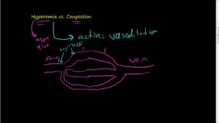 46Hyperemia vs Congestion [upl. by Alletniuq714]