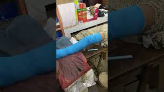 Fiber plaster  full video AR Medical Gyan is live [upl. by Thrift]