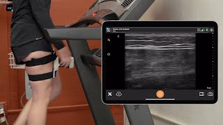 Dynamic Rectus Femoris Assessment Using Usono ProbeFix [upl. by Centeno961]