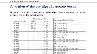 Diagnosis of environmental mycobacteria and relevance of susceptibility testing [upl. by Hurwit812]