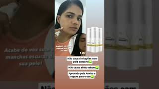 Clareador de Melasma Nutralfit Clareia Manchas definitivamente produtosdebelezaeemagrecimento [upl. by Zilvia]