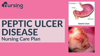 What is Peptic Ulcer Disease and how to care for it Nursing Care Plan [upl. by Nwahsyd820]