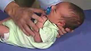 Moro Reflex Best part of Pediatric [upl. by Analad932]