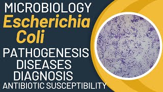 Escherichia coli pathogenesis  E coli microbiology  e coli general properties [upl. by Aek]