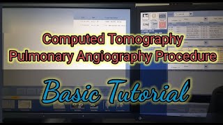 Actual Pulmonary Angiography Computed Tomography ProcedureBasic Tutorial [upl. by Hareehat948]