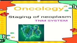 TNM staging of cancer in easy way  oncology staging lecture  staging in hindi 😊 [upl. by Godliman481]