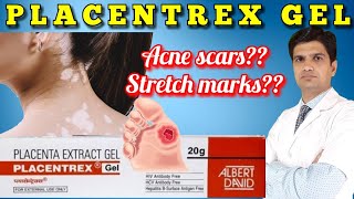 Placentrex gel  Placenta extract gel  Placentrex gel uses in hindi  LEARN ABOUT MEDICINE [upl. by Adnovaj]