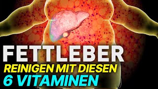 6 Vitamine um eine Fettleber zu reinigen [upl. by Hafinah]