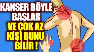 Kanser Olduğunuzu Gösteren 20 İşaret  Bu Belirtilerden Biri Bile Varsa Hemen Doktora Gidin [upl. by Ame873]