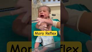 Moro reflex in newborn babyviral [upl. by Boys592]