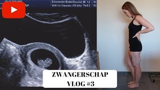 EERSTE ECHO amp MISSELIJK  6 7 amp 8 weken  ZWANGERSCHAP VLOG 3 [upl. by Halilad536]