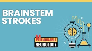 Brainstem Stroke Mnemonics Memorable Neurology Lecture 15 [upl. by Hut792]