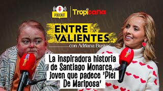 Santiago Monarca La inspiradora historia de joven que padece Piel De Mariposa [upl. by Akere]