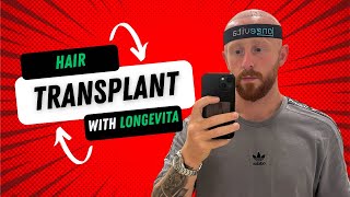 Hair Transplant with Longevita [upl. by Beatrice]