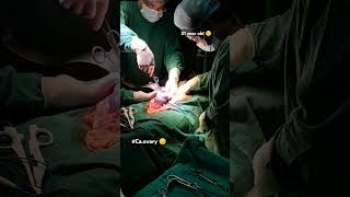 31 year old Interval debulking surgery😔🤲 caovarymedicalstudent doctor viralshort video 🙏🛐 [upl. by Emilee]