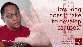 How long does it take to develop calluses [upl. by Alahs]