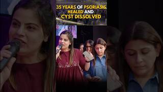 35 years of Psoriasis healed and cyst dissolved [upl. by Kristien641]